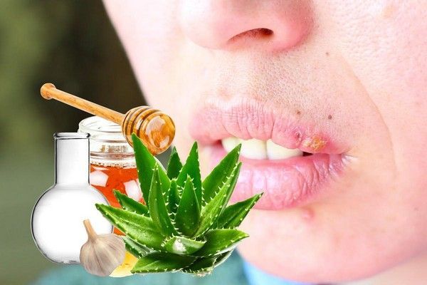 Герпестан коткара